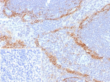Podoplanin Antibody / gp36