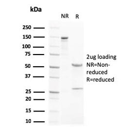 LXRB Antibody / NR1H2