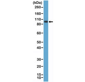Western blot testing of human K562 cell lysate with recombinant SATB2 antibody at 1:1000 dilution. P