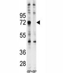 Western blot analysis of Ubiquilin-1 antibody pre-incubated with and without blocking peptide in Jur