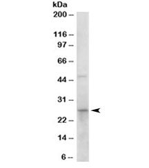 Western blot testing of human duodenum lysate with 15-PGDH antibody at 0.1ug/ml. Predicted molecular