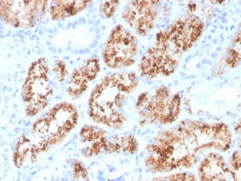 Retinol Binding Protein 4 Antibody / RBP4