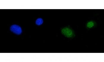 RPA70 Antibody / RPA1