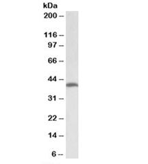Western blot testing of human colorectal cancer lysate with THNSL2 antibody at 2ug/ml. Predicted mol