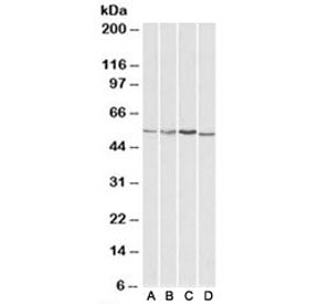 Western blot testing of HepG2 [A], Jurkat [B], mouse brain [C] and rat brain [D] lysates with AKT3 a