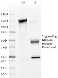 MMP2 Antibody