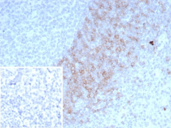 IHC staining of FFPE human lymph node tissue with IgD Heavy Chain antibody (clone IGHD/4967). Inset: