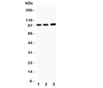 Western blot testing of EPB41L1 antibody and Lane 1: rat brain; 2: mouse brain; 3: human A549. Predi