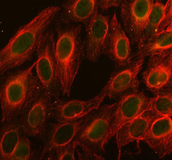 Immunofluorescent staining of FFPE human U-2 OS cells with CDC25 antibody (green) and Alpha Tubulin 