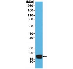 Western blot testing of human HeLa cell lysate with recombinant STMN1 antibody at 1:5000 dilution. E