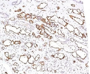 IHC testing of FFPE human kidney transplant tissue stained with C4d antibody (clone CPT4d-1). Staini