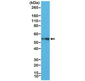Western blot testing of human Jurkat cell lysate with recombinant CD4 antibody at 1:2500. Expected m