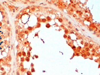 IHC testing of FFPE human testis with UBC3B antibody at 2ug/ml. HIER: steamed with pH6 citrate buffe