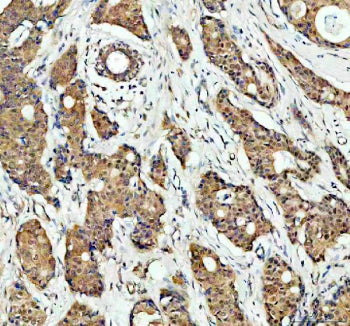 Immunohistochemical staining of MAPK14 using anti- MAPK14 antibody. MAPK14 was detected in a paraffi
