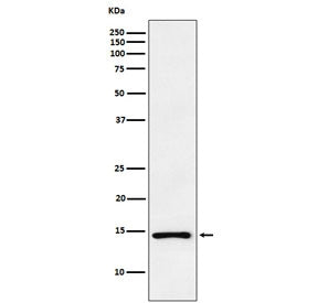 Western blot testing of human PC-3 cell lysate with Atrial Natriuretic Peptide antibody. Predicted m