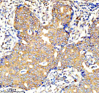 IHC analysis of AMPD1 using anti-AMPD1 antibody. AMPD1 was detected in a paraffin-embedded section o