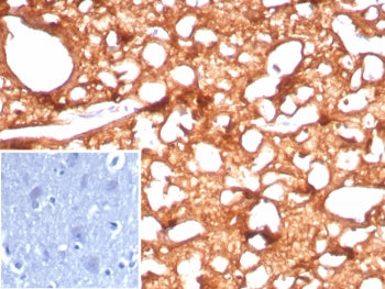 IHC staining of FFPE human brain tissue with Brain Creatine Kinase antibody (clone CKBB/8843R). Inse