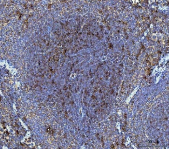 Dkk1 Antibody