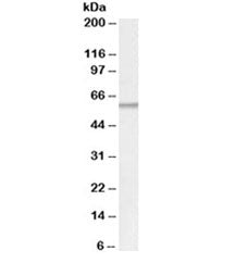 Western blot testing of human adipose lysate with ATGL antibody at 0.5ug/ml. Predicted molecular wei