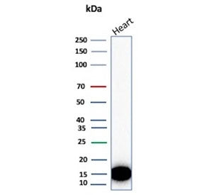 Western blot testing of different lots of human heart lysate with H-FABP antibody. Predicted molecul