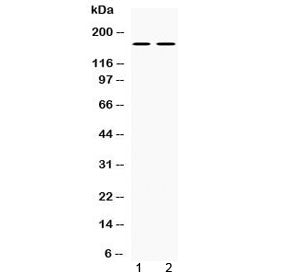 Western blot testing of 1) rat brain and 2) mouse brain lysate with NOS1 antibody at 0.5ug/ml. Predi