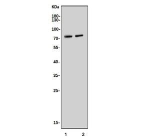 Western blot testing of 1) rat liver and 2) mouse liver tissue lysate with Narc1 antibody. Predicted