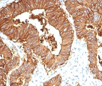 EpCAM Antibody / Cytoplasmic domain