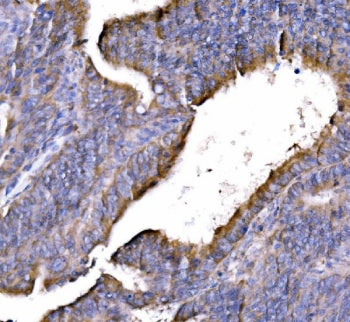 GGA3 Antibody