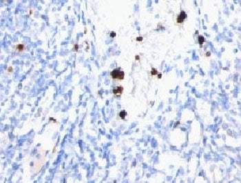 IHC testing of FFPE human tonsil with MYDAM antibody (clone MYUP1). FFPE testing requires sections t