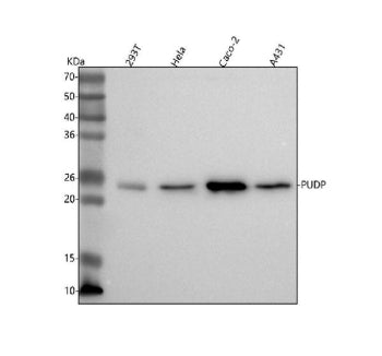 Western blot analysis of PUDP using anti-PUDP antibody. Lane 1: human 293T whole cell lysates, Lane 