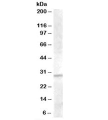 Western blot testing of human liver lysate with IGFBP4 antibody at 1ug/ml. Predicted molecular weigh