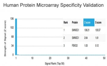 Analysis of HuProt(TM) microarray containing more than 19,000 full-length human proteins using SMNDC