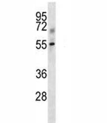 Tgfbr1 antibody western blot analysis in mouse kidney tissue lysate. Predicted molecular weight: ~55