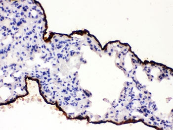 Mesothelin Antibody