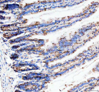 Immunohistochemical staining of Neurokinin 1 Receptor using anti-NKR1 antibody. Neurokinin 1 Recepto