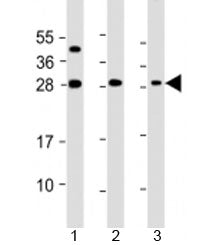 TPD52 Antibody / Tumor protein D52
