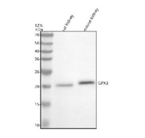 Western blot analysis of GPX3 using anti-GPX3 antibody. Electrophoresis was performed on a 12% SDS-P