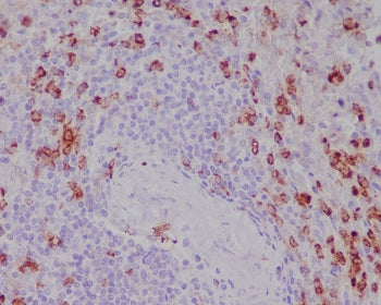 IHC staining of FFPE human spleen tissue with CD11b antibody. HIER: boil tissue sections in pH6, 10m