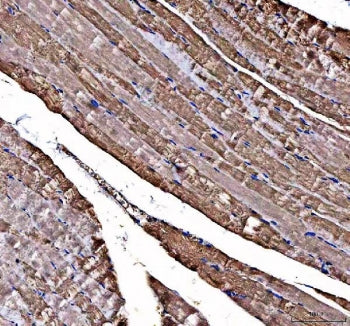 IHC staining of FFPE human skeletal muscle tissue with DOK7 antibody. HIER: boil tissue sections in 