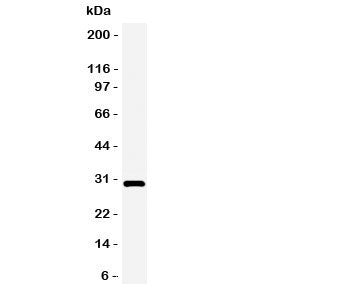 Western blot testing of Adiponectin antbody and rat heart tissue lysate. Expected/observed size ~30K