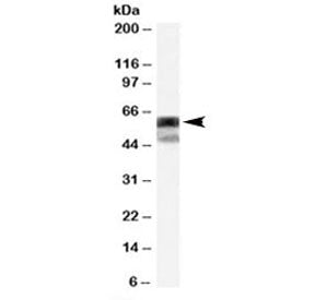 Western blot testing of HEK293 cell lysate with P4HA1 antibody at 0.2ug/ml. The expected ~60 kDa and