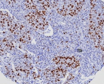 Ki-67 Antibody