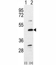 Western blot analysis of BMP7 antibody and 293 cell lysate either nontransfected (Lane 1) or transie