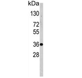 Western blot testing of human T-47D cell lysate with NANOS1 antibody. Predicted molecular weight: ~3