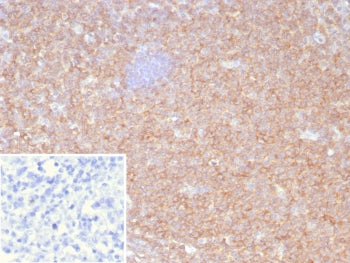 IHC staining of FFPE human tonsil tissue with HLA-B antibody (clone JOAN-1). HIER: boil tissue secti