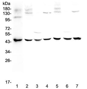 Western blot testing of 1) human MCF7, 2) rat brain, 3) rat kidney, 4) rat testis, 5) mouse brain, 6