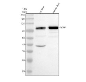 Western blot analysis of TGM7 using anti-TGM7 antibody. Electrophoresis was performed on a 10% SDS-P
