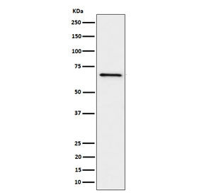 Western blot testing of human Ramos cell lysate with GRK6 antibody. Predicted molecular weight ~66 k