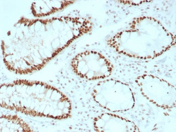 IHC staining of FFPE human colon tissue with recombinant SATB2 antibody (clone rSATB2/8634). HIER: b