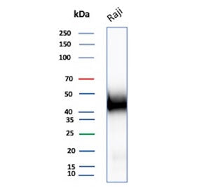 Western blot testing of human Raji cell lysate with CD48 antibody. Expected molecular weight: 28-50 